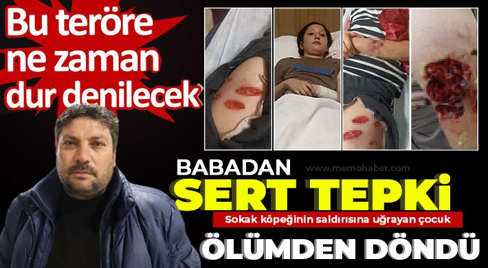 Köpeğin ısırdığı çocuğun vücudunun çeşitli yerlerinde derin yaralar oluştu