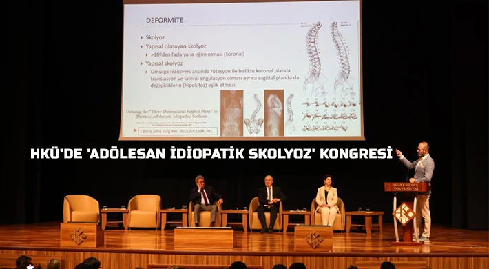 HKÜ’de 'Adölesan İdiopatik Skolyoz' kongresi