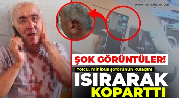  Yolcu, minibüs şoförünün kulağını ısırarak koparttı