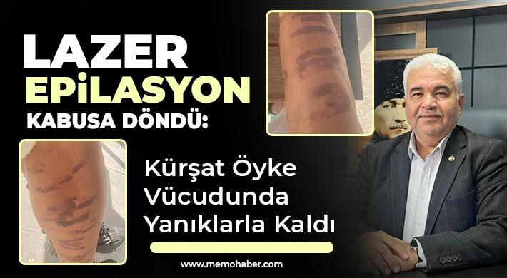 Lazer Epilasyon Kabusa Döndü: Kürşat Öyke Vücudunda Yanıklarla Kaldı
