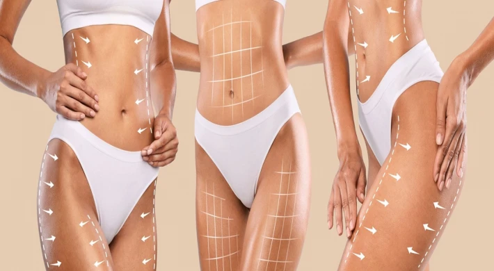 Uygun Liposuction Fiyatları ile Hayalinizdeki Görünüme Kavuşun