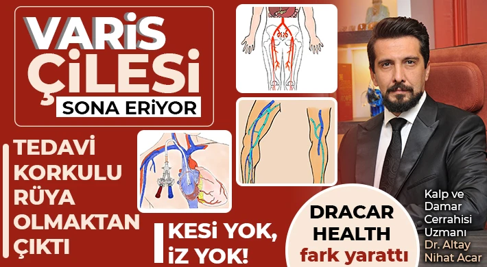 Varis çilesi sona eriyor