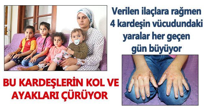 4 kız kardeşin vücudunun her yeri yaralarla kaplandı...
