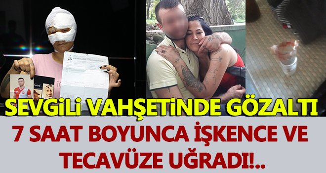 7 saat boyunca işkence yaptı! Gözaltına alındı...