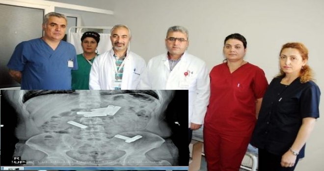 GAZİANTEP'TE MAHKUMUN MİDESİNDEN 8 PİL ÇIKTI