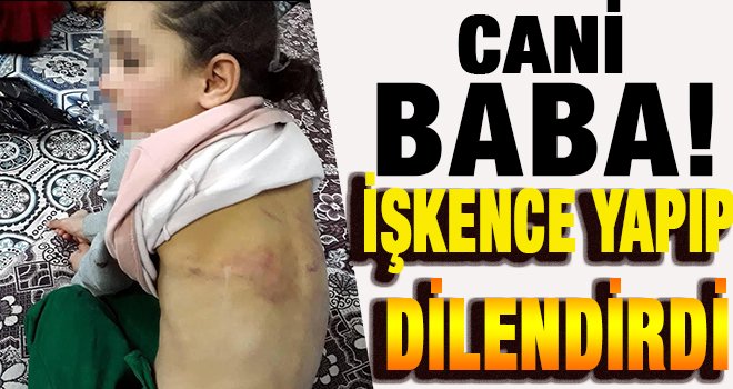 Babasından işkence gören çocuk devlet korumasında