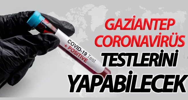 2 saat içinde numune sonuçları açıklanacak