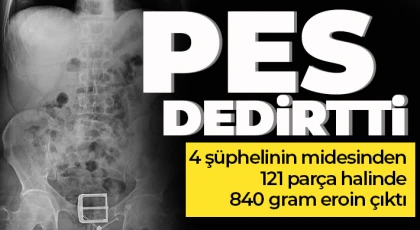4 şüphelinin midesinden 121 parça halinde 840 gram eroin çıktı