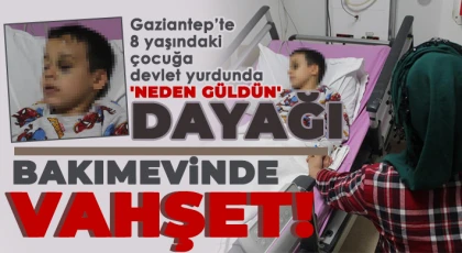 Çocuk hizmetleri yurdunda kalan 8 yaşındaki çocuğa darp iddiası