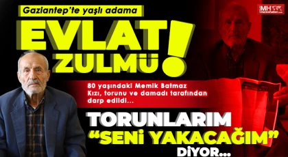 Miras kavgası 80 yaşındaki Memik Batmaz'ı hastanelik etti