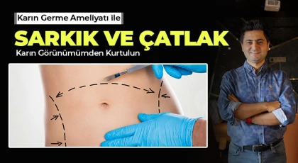 Karın germe ameliyatı ile estetik bir karın görünümüne sahip olun