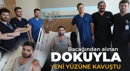 Bacağından alınan dokuyla yeni yüzüne kavuştu