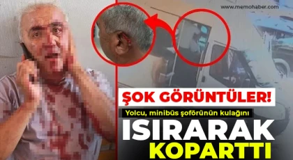  Yolcu, minibüs şoförünün kulağını ısırarak koparttı