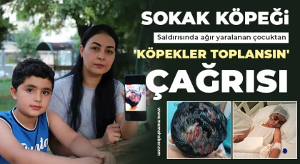 Köpek saldırısı sonrası zor günler geçiren anne ve küçük oğlu yaşadıklarını anlattı