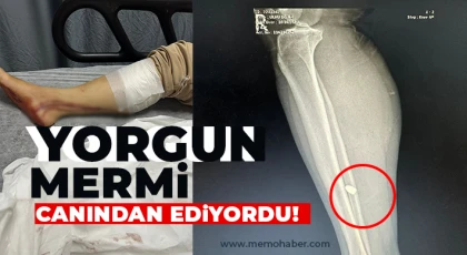 Nizip'te sokak'ta yürüyen kadına yorgun mermi isabet etti