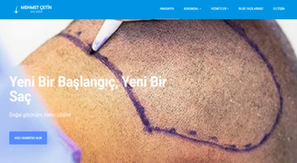 Mehmet Çetin Saç Ekimi - Doğallığın ve Güvenin Adresi