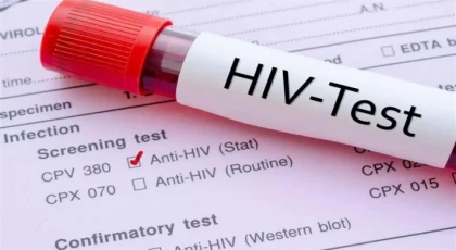 Hiv Testi