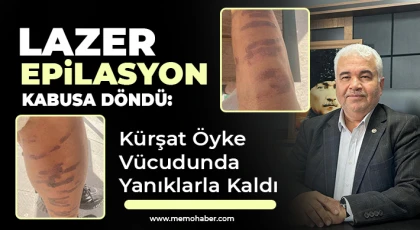 Lazer Epilasyon Kabusa Döndü: Kürşat Öyke Vücudunda Yanıklarla Kaldı