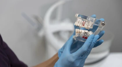 Antalya’da Ağız ve Diş Sağlığına Yönelik Talep Çeşitleniyor: İmplant Tedavisi ve Pedodonti Öne Çıkıyor