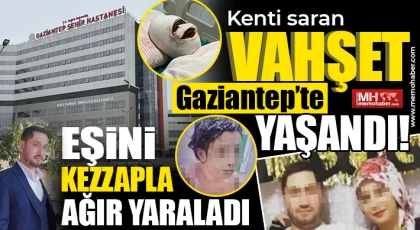 Gaziantep'te vahşet: Eşini kezzapla ağır yaraladı