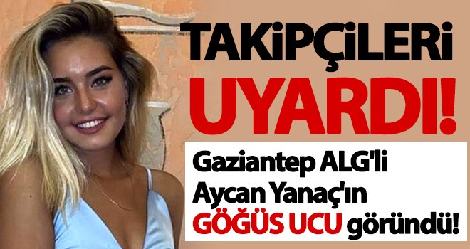 Aycan Yanaç’ın göğüs ucu göründü! Sosyal medya çalkalandı