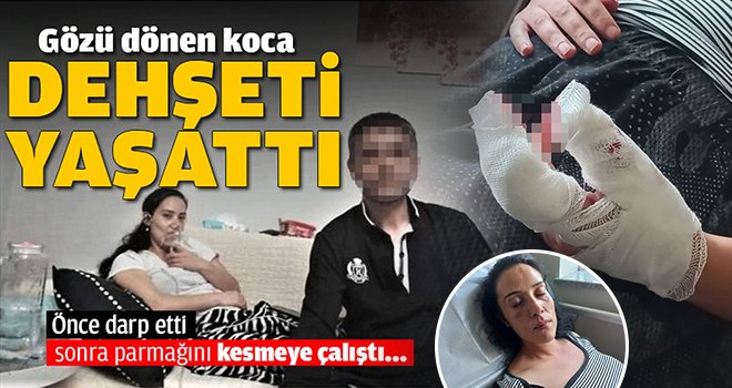 Bir anda cinnet geçirdi! Bıçakla parmağını kesmeye çalıştı