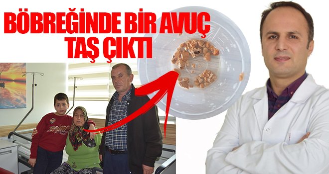 Böbrek taşından kurtulmak artık çok kolay