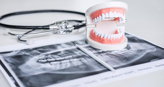 Diş eti kaşıntısı​