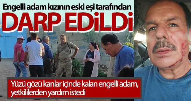 Engelli adam kızının eski eşi tarafından darp edildi