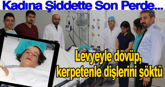 Eşini levyeyle dövüp, kerpetenle dişlerini söktü!..