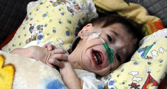 Gaziantep'te 1 yaşında kalp hastası olan bebek yardım bekliyor