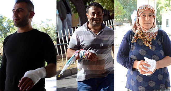 GAZİANTEP’TE 107 ACEMİ KASAP YARALANDI 