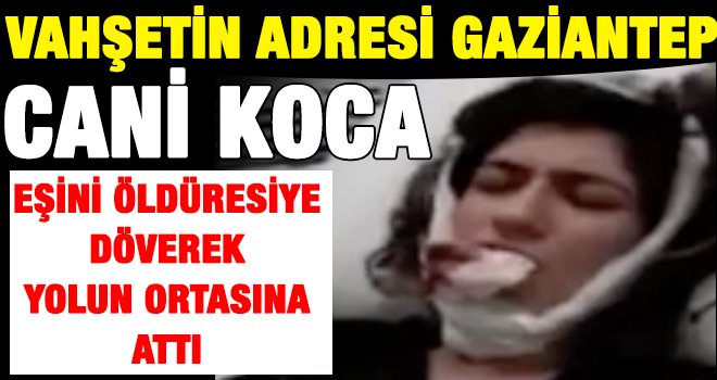 Gaziantep'te koca dehşeti! Ölü taklitiyle kurtuldu...