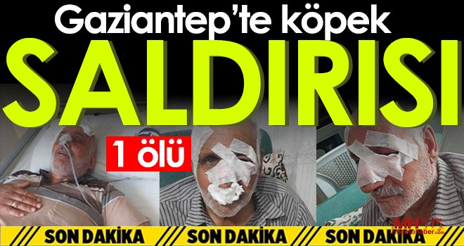 Gaziantep’te köpek saldırısı! 1 ölü