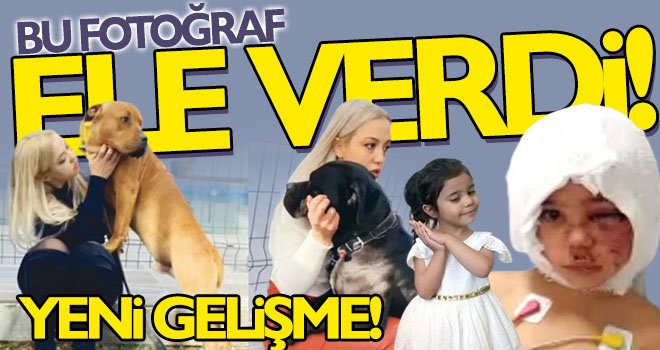 Gaziantep'teki pitbull dehşetinde yeni gelişme!..