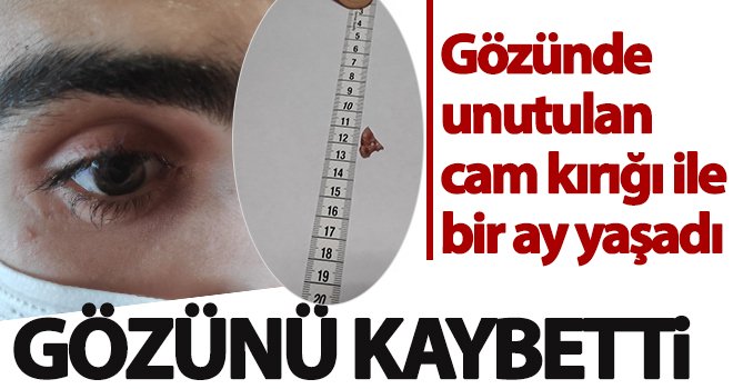 Gözünde cam kırığı fark edilen genç, sağ gözünü kaybetti