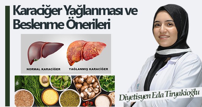 Karaciğer Yağlanması ve Beslenme Önerileri 