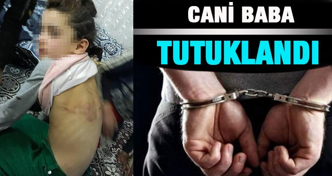 Kızına işkence yapıp dilendiren Suriyeli tutuklandı