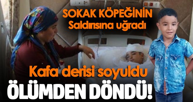 Köpek saldırısına uğrayan 6 yaşındaki çocuğun kafa derisi soyuldu