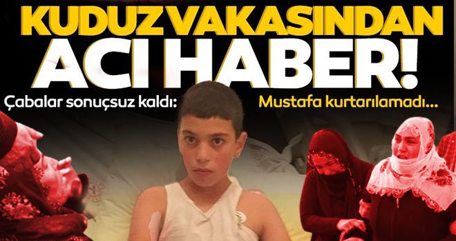 Kuduz dehşeti! O çocuk hayatını kaybetti