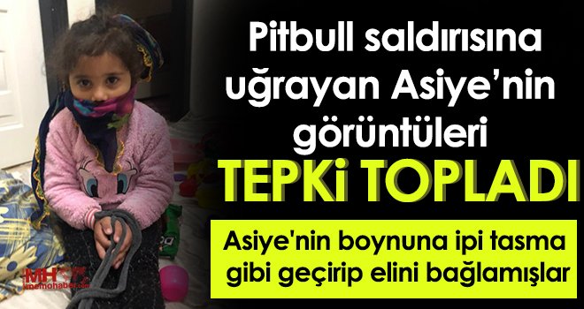 Pitbull saldırısına uğrayan Asiye’nin görüntüleri tepki topladı