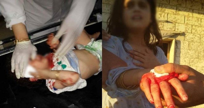 PYD, Azez'de sivillere saldırdı: 2 ölü, 4 yaralı