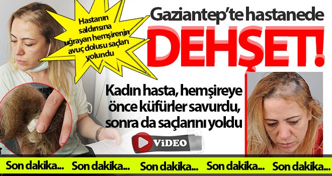 Sağlıkta şiddet! Küfürler savurdu, sonra da saçlarını yoldu