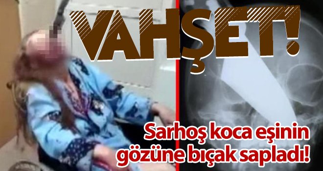 Sarhoş koca, eşinin gözüne bıçak sapladı
