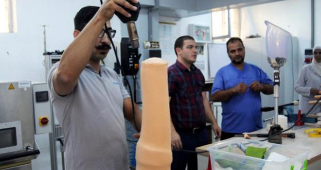 Savaş mağduru Suriyelilere, Gaziantep'te ücretsiz protez