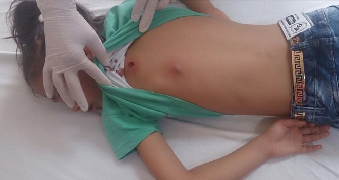 Suriyeli kız maganda kurbanı