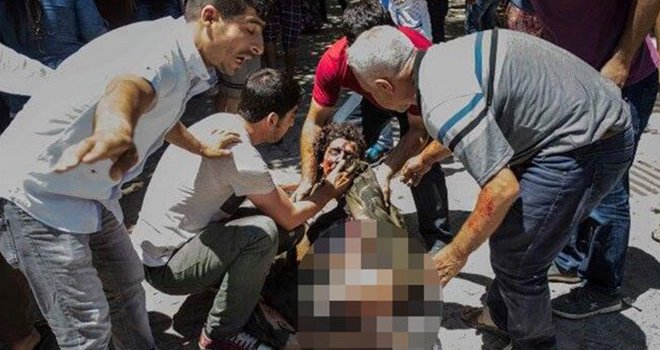 Suruçtaki Patlamada Canlı Bomba 