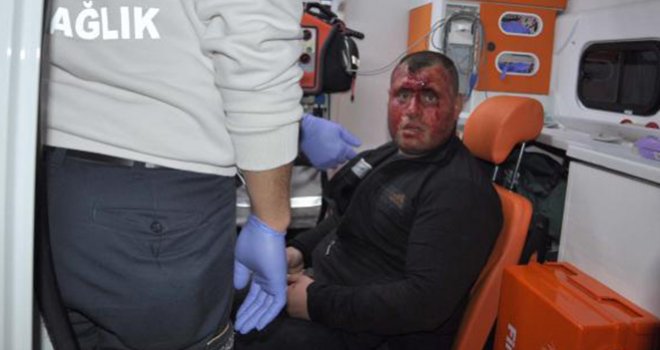 Tıraş olurken yüzünü kesti hastanelik oldu