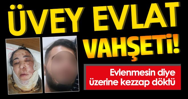 Üvey evlat vahşeti! Evlenmesin diye üzerine kezzap döktü