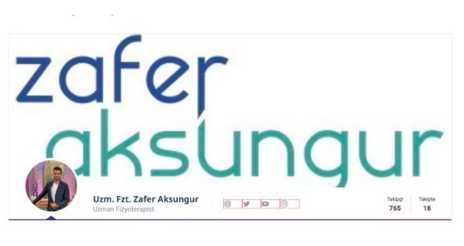 Uzman fizyoterapist Zafer Aksungur, KizlarSoruyor kullanıcılarının sorularını yanıtlıyor